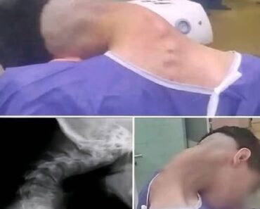 Young man hospitalized because he dropped his ca…See more Young man hospitalized because he dropped his ca…See more