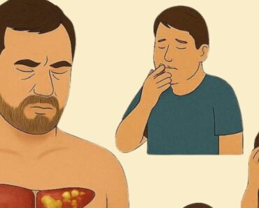 These are the symptoms that war:n you that you have fatty liver find out what to do and how to combat it.