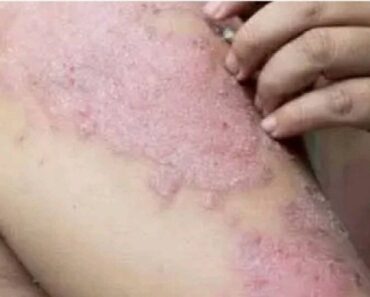 HT15. These are the consequences of sleeping with the…See more – Daily News