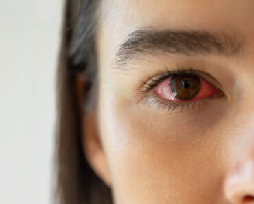 These are the consequences of sleeping with…See more – Daily News