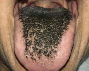 These are the consequences of sleep These are the consequences of sleep