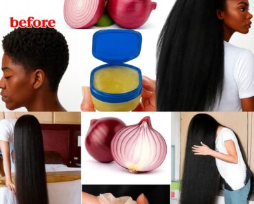 Vaseline + Onion Juice Hair Mask: The Viral Remedy Explained (Realistic Results) Vaseline + Onion Juice Hair Mask: The Viral Remedy Explained (Realistic Results)