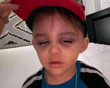 A 3-year-old boy was A 3-year-old boy was