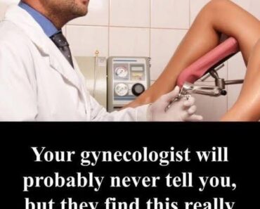 Many women recognize