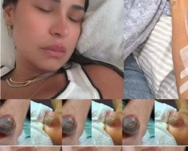 The Real Consequences of The Real Consequences of