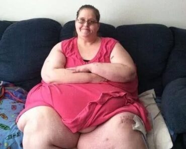 This Woman Lost 760 Pounds and Here is This Woman Lost 760 Pounds and Here is